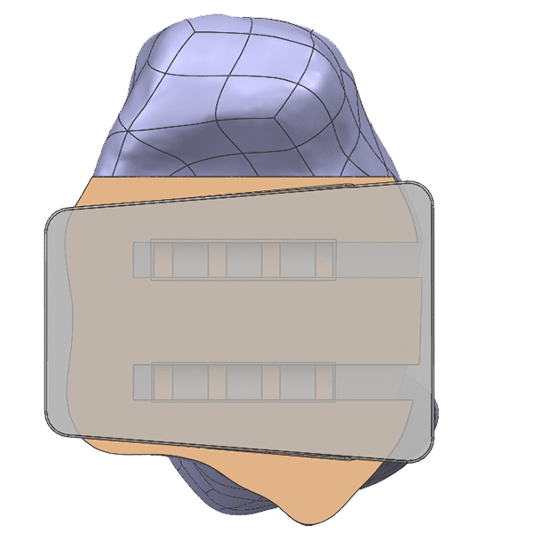 Historical Ankle Design