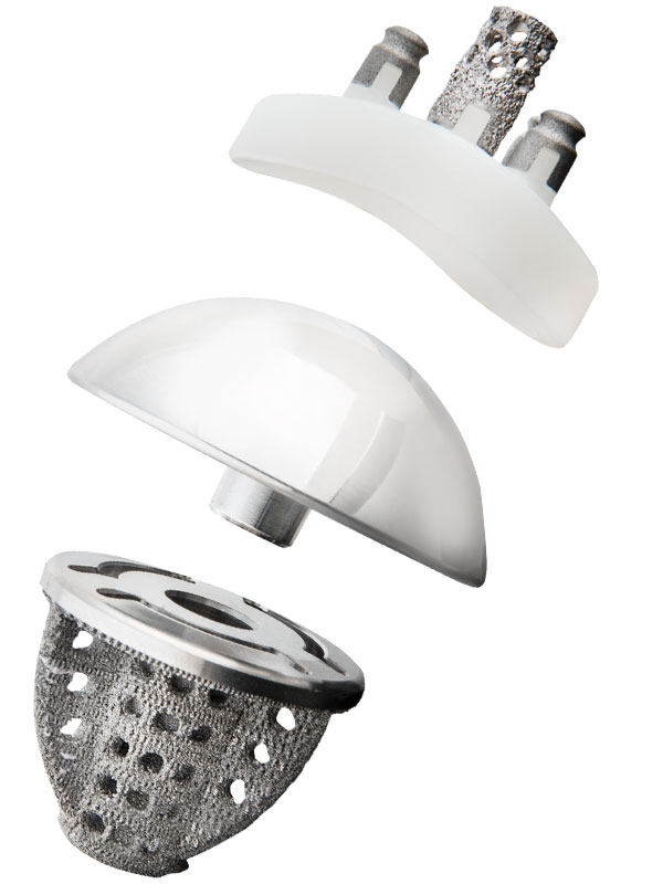 Equinoxe Stemless Shoulder