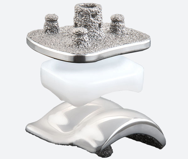 Sistema per caviglia totale Vantage