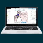 Advita Ortho Active Intelligence Shoulder Planning App